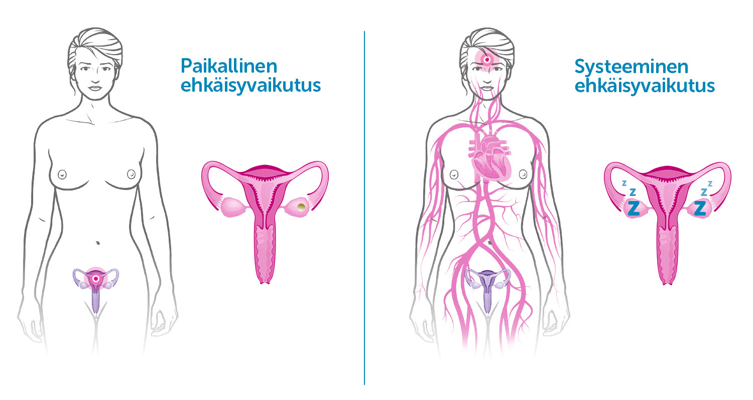 ehkaisyvaikutus